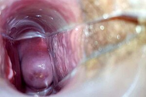 The Speculum exploration will lead to a very rigorous orgasm