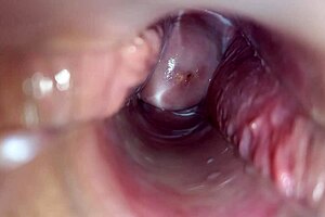 Close up of a woman’s orgasm with a speculum